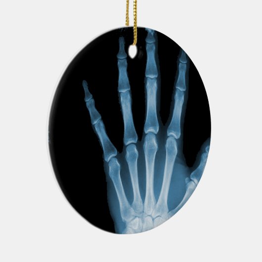 X-RAY SKELETON HAND FINGERS BLUE KERAMISCH ORNAMENT (Rechts)