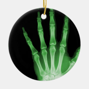 X-RAY SKELETON HAND FINGERS GREEN KERAMISCH ORNAMENT