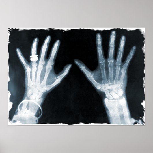 X-Ray Skeleton Hands & Juwelry - Blauw Poster (Voorkant)