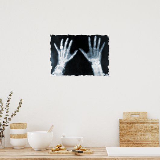 X-Ray Skeleton Hands & Juwelry - Blauw Poster (Keuken)