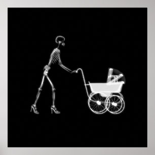 X-Ray Skeleton Mam & Baby - Oorspronkelijke softwa Poster