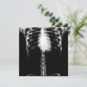 X-RAY SKELETON TORSO RIBS - B&W KAART (Staand voorkant)