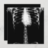 X-RAY SKELETON TORSO RIBS - B&W KAART (Voorkant / Achterkant)