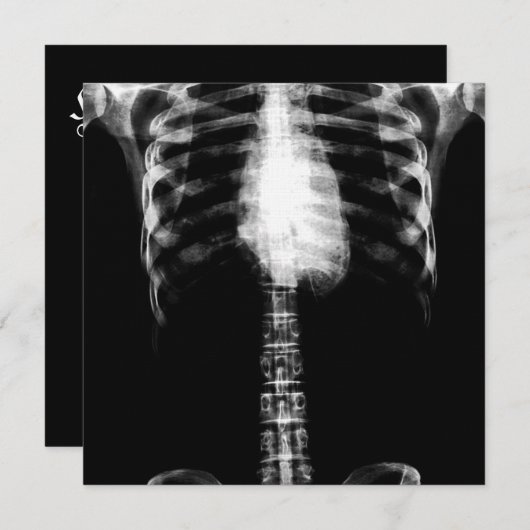 X-RAY SKELETON TORSO RIBS - B&W KAART (Voorkant / Achterkant)