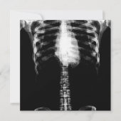 X-RAY SKELETON TORSO RIBS - B&W KAART (Voorkant)