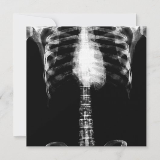X-RAY SKELETON TORSO RIBS - B&W KAART (Voorkant)