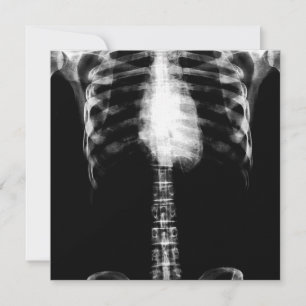 X-RAY SKELETON TORSO RIBS - B&W KAART