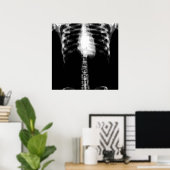 X-RAY SKELETON TORSO RIBS - B&W POSTER (Thuiskantoor)