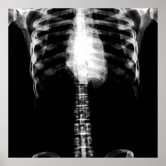 X-RAY SKELETON TORSO RIBS - B&W POSTER (Voorkant)