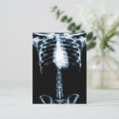 X-RAY SKELETON TORSO RIBS BLUE BRIEFKAART (Staand voorkant)