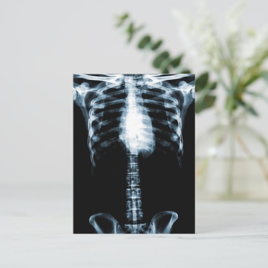 X-RAY SKELETON TORSO RIBS BLUE BRIEFKAART (Staand voorkant)