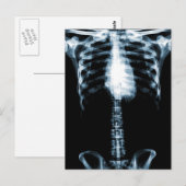 X-RAY SKELETON TORSO RIBS BLUE BRIEFKAART (Voorkant / Achterkant)
