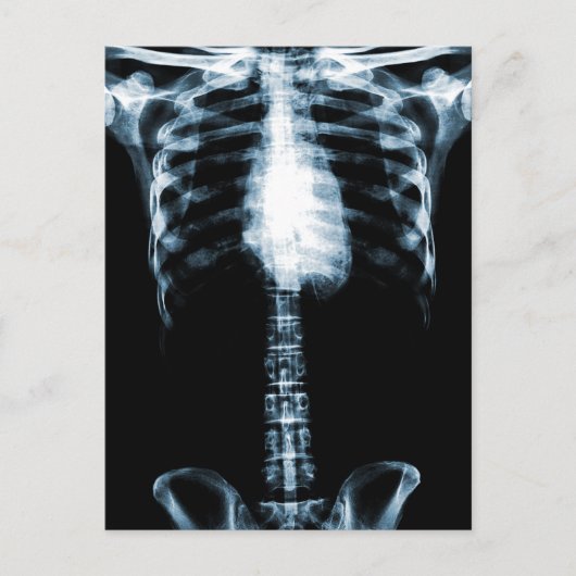 X-RAY SKELETON TORSO RIBS BLUE BRIEFKAART (Voorkant)