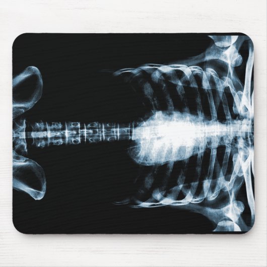 X-RAY SKELETON TORSO RIBS - BLUE MUISMAT (Voorkant)