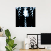 X-RAY SKELETON TORSO RIBS - BLUE POSTER (Thuiskantoor)