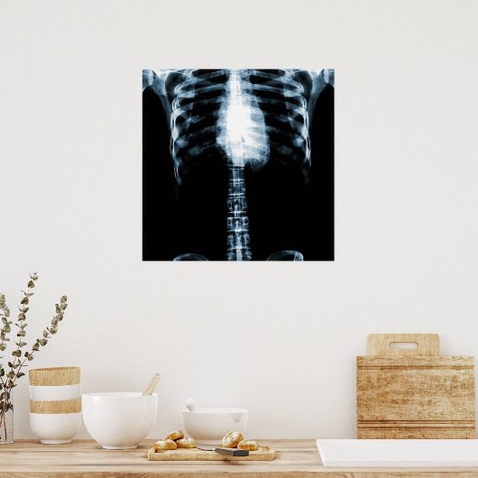 X-RAY SKELETON TORSO RIBS - BLUE POSTER (Keuken)