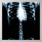 X-RAY SKELETON TORSO RIBS - BLUE POSTER (Voorkant)