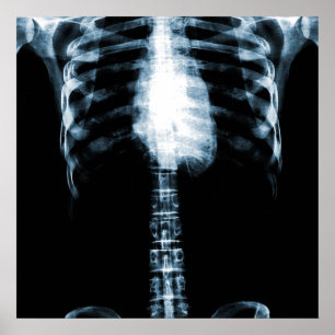 X-RAY SKELETON TORSO RIBS - BLUE POSTER
