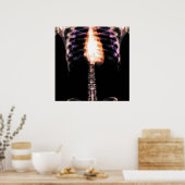 X-RAY SKELETON TORSO RIBS - ORIGINEEL POSTER (Keuken)