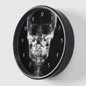 X-Ray Skull - B&W (Hoek)