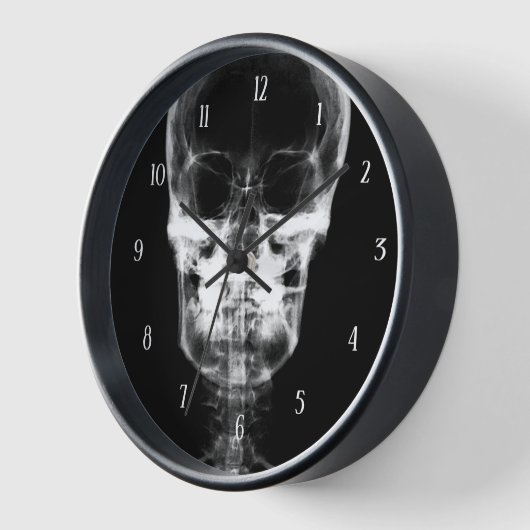 X-Ray Skull - B&W (Hoek)