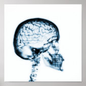 X-RAY SKULL BRAIN - BLAUW POSTER (Voorkant)