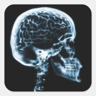 X-RAY SKULL BRAIN - BLAUW VIERKANTE STICKER