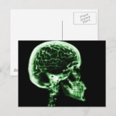 X-RAY SKULL BRAIN - GROEN BRIEFKAART (Voorkant / Achterkant)