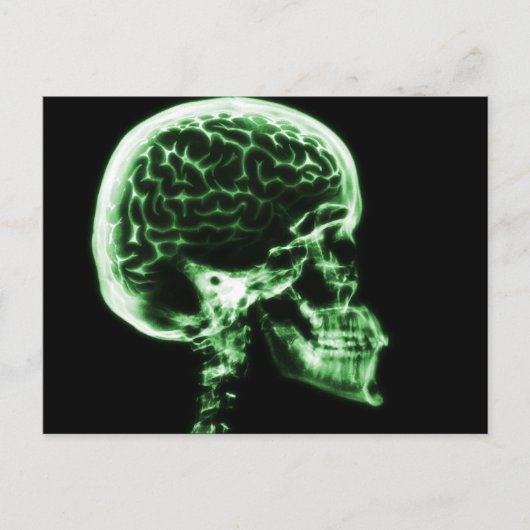 X-RAY SKULL BRAIN - GROEN BRIEFKAART (Voorkant)