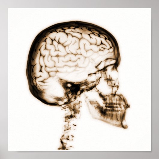 X-RAY SKULL BRAIN - ORANJE POSTER (Voorkant)