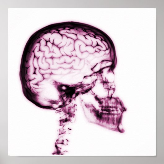 X-RAY SKULL BRAIN - PINK POSTER (Voorkant)