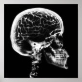 X-RAY SKULL BRAIN - ZWART EN WITTE POSTER (Voorkant)