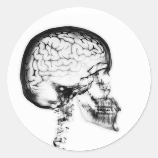 X-RAY SKULL BRAIN - ZWART EN WITTE RONDE STICKER (Voorkant)