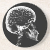 X-RAY SKULL BRAIN - ZWART EN WITTE ZANDSTEEN ONDERZETTER (Voorkant)
