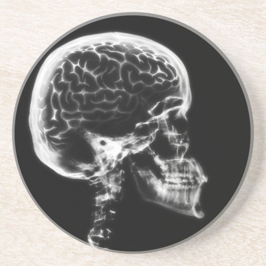 X-RAY SKULL BRAIN - ZWART EN WITTE ZANDSTEEN ONDERZETTER (Voorkant)