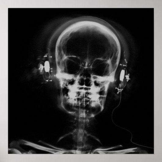 X-Ray Skull met hoofdtelefoon - B&W Poster (Voorkant)
