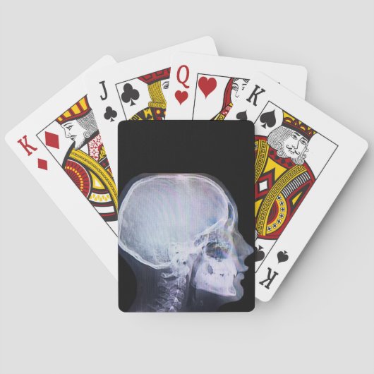X-Ray-speelkaarten Pokerkaarten (Achterkant)