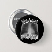 X-Ray Technologen.... Ronde Button 5,7 Cm (Voorkant /achterkant)