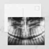 X-Ray Teeth Mouth Smile Black en White Briefkaart (Voorkant / Achterkant)