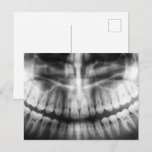 X-Ray Teeth Mouth Smile Black en White Briefkaart (Voorkant / Achterkant)