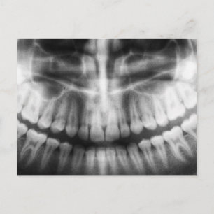 X-Ray Teeth Mouth Smile Black en White Briefkaart