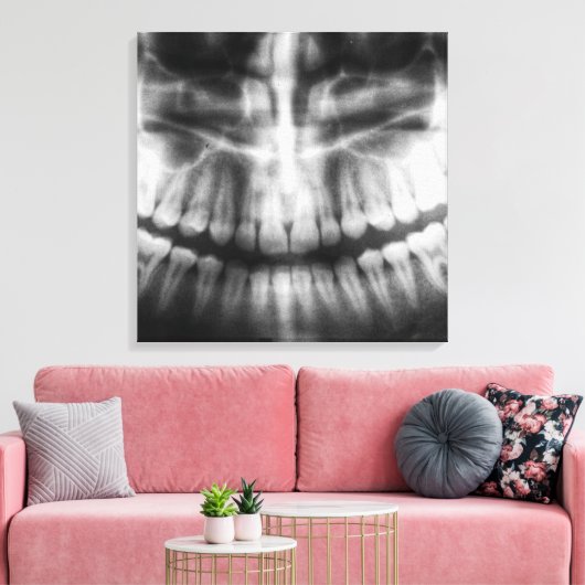 X-Ray Teeth Mouth Smile Black en White Canvas Afdruk (Insitu (Woonkamer))