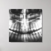 X-Ray Teeth Mouth Smile Black en White Canvas Afdruk (Voorkant)