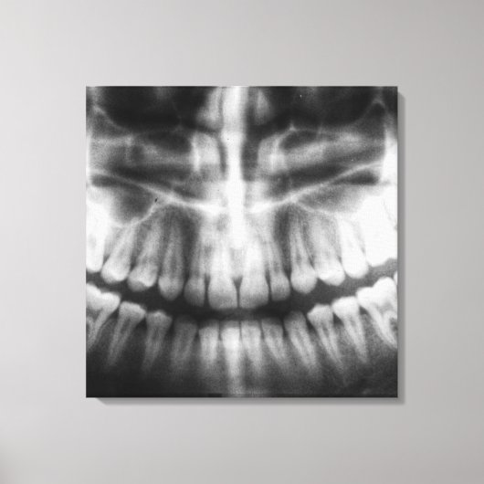 X-Ray Teeth Mouth Smile Black en White Canvas Afdruk (Voorkant)