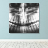 X-Ray Teeth Mouth Smile Black en White Canvas Afdruk (Insitu (Houten vloer))