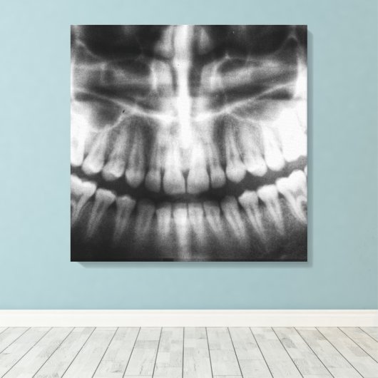 X-Ray Teeth Mouth Smile Black en White Canvas Afdruk (Insitu (Houten vloer))
