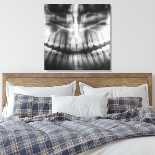 X-Ray Teeth Mouth Smile Black en White Canvas Afdruk (Insitu (Slaapkamer))