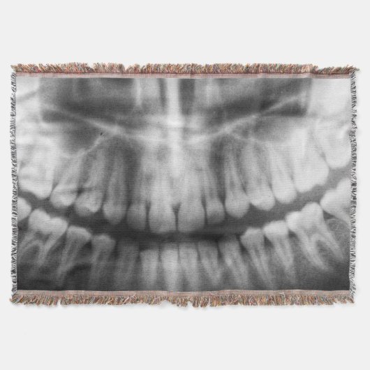 X-Ray Teeth Mouth Smile Black en White Deken (Voorkant)