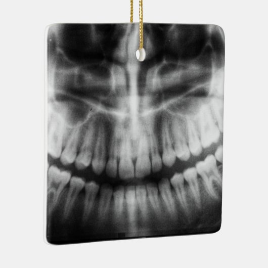 X-Ray Teeth Mouth Smile Black en White Keramisch Ornament (Rechts)