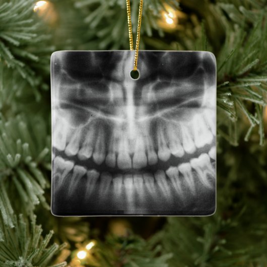 X-Ray Teeth Mouth Smile Black en White Keramisch Ornament (Boom)